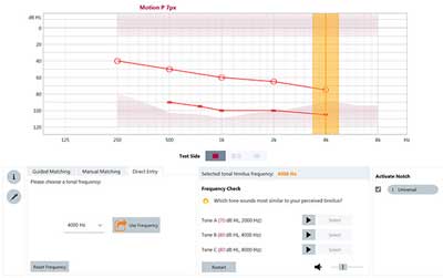Tinnitus_product7.jpg Tinnitus_product7.jpg