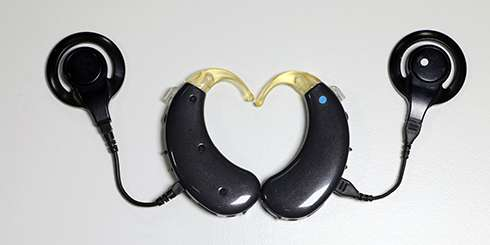 Кохлеарный имплант